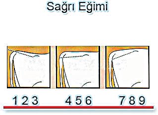 sağrı eğimi